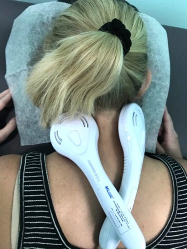 ML830 Smart Laser Console and two Tri-Diode Laser Paddles shown being used on neck trigger points of patient for pain relief